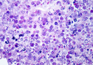Imagem de células somáticas (DMSCC)